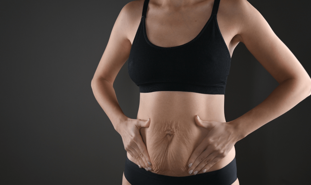 tirzepatide weight loss belmont for in Boynton Beach, Florida- Cost, Insurance Options Weight Loss Webinar - Charlotte